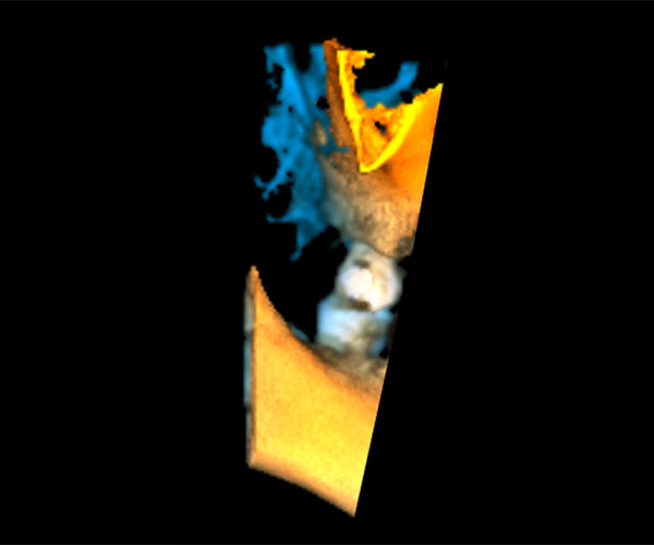 СКТ 1 зуб (200грн.) Image